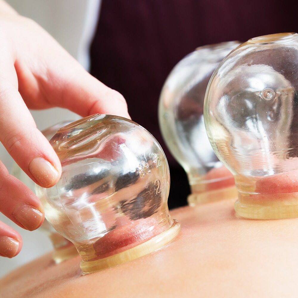 pain relief recovery cupping